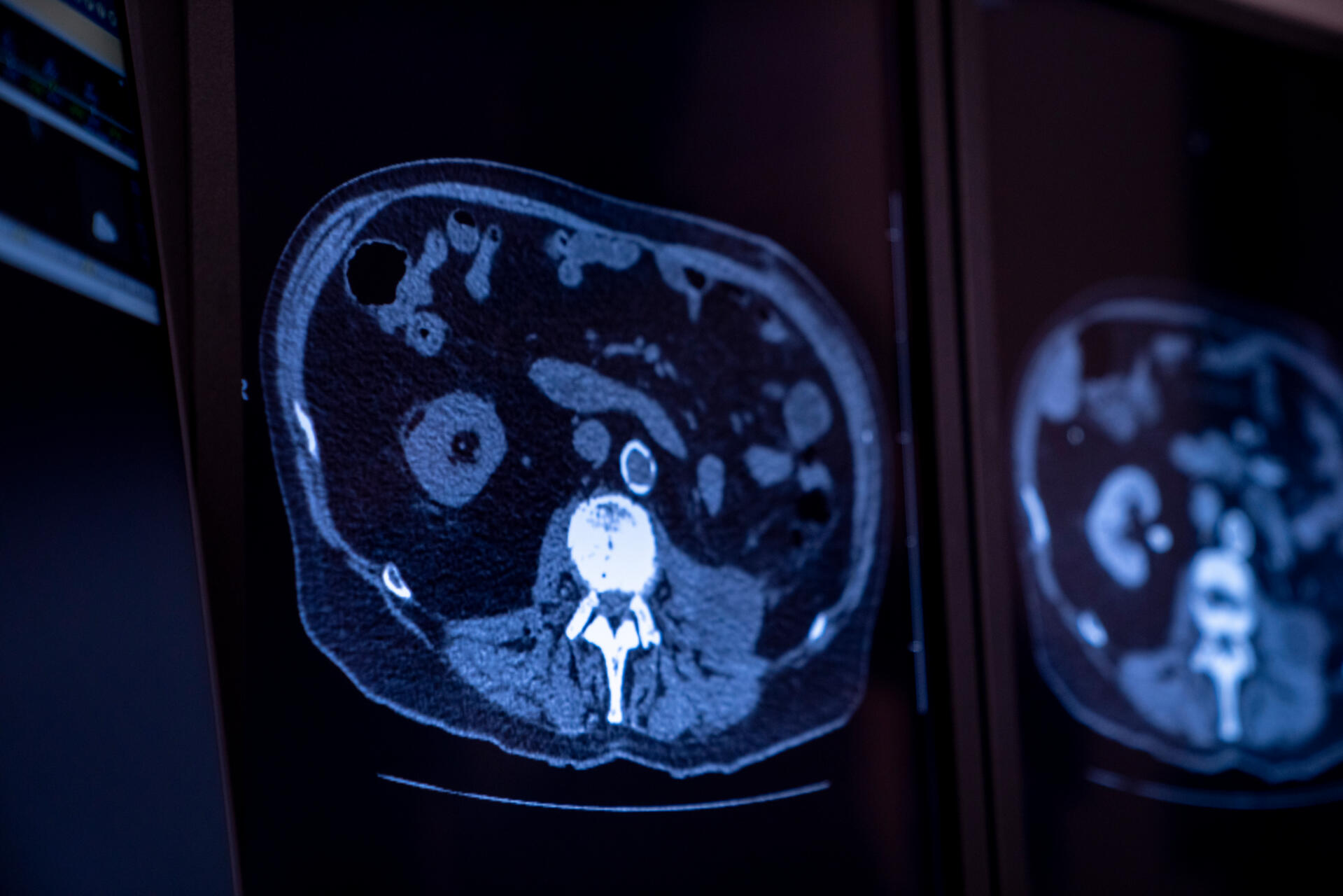 UNE RADIOLOGIE MODERNISÉE