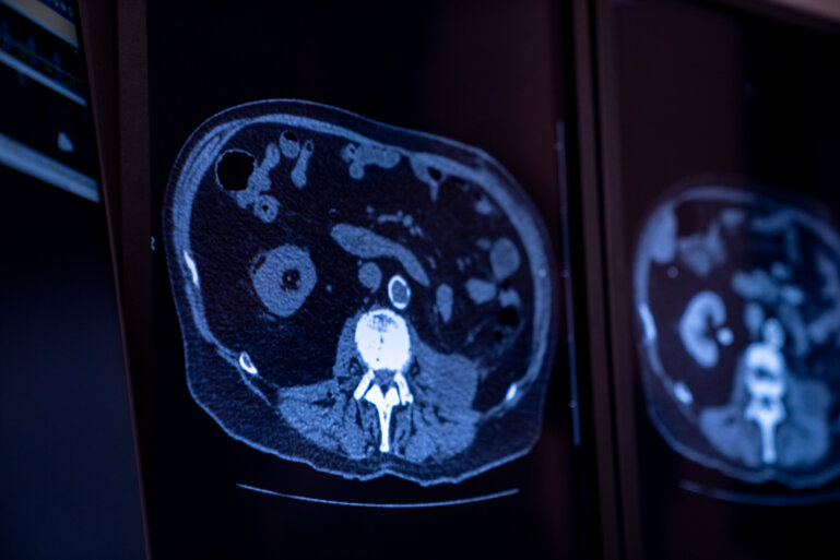 UNE RADIOLOGIE MODERNISÉE